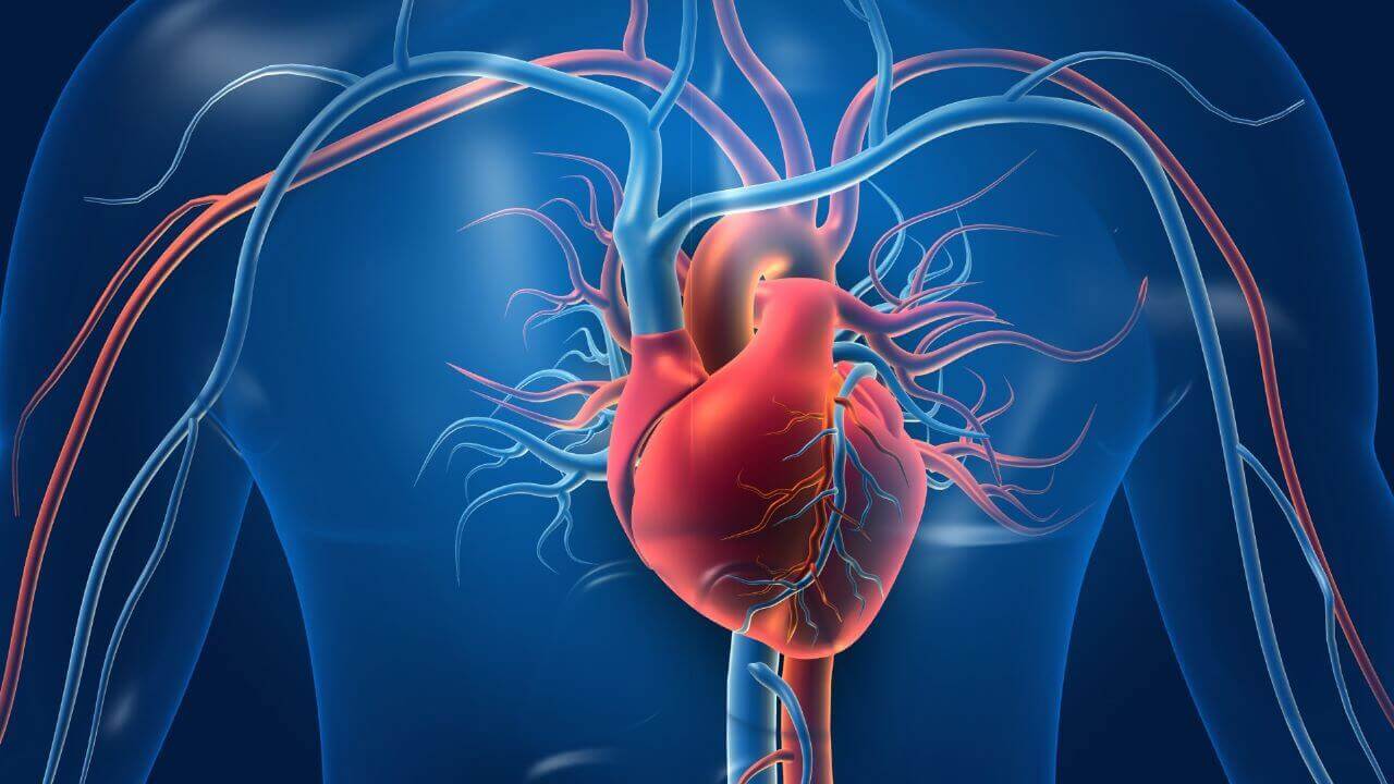 Coronary Artery Disease & AMI